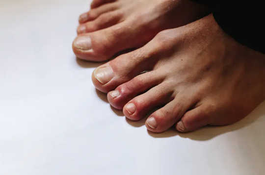 8 Ways The Coronavirus Can Affect Your Skin 8 Ways The Coronavirus Can Affect Your Skin