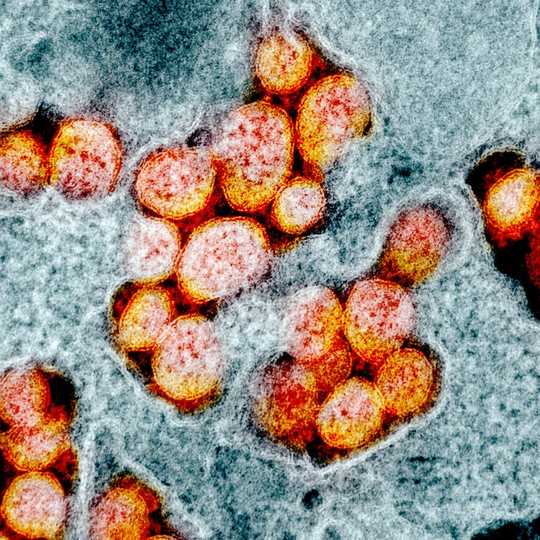 What We Know About COVID-19's Infectivity And Viral Load What We Know About COVID-19's Infectivity And Viral Load
