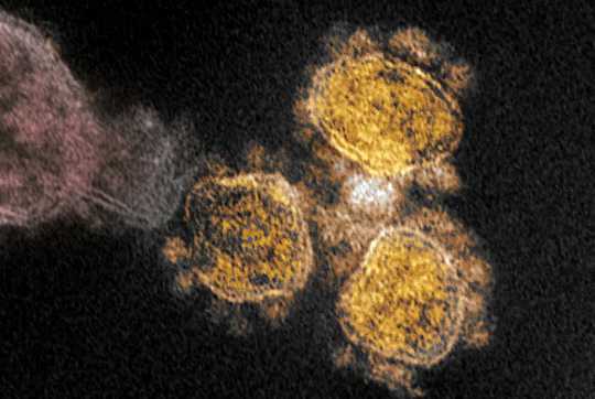How To Stay Safe With A New Fast-spreading Coronavirus Variant On The Loose How To Stay Safe With A New Fast-spreading Coronavirus Variant On The Loose